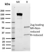 Band III Antibody in SDS-PAGE (SDS-PAGE)