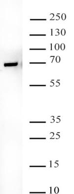 YTHDF2 Antibody in Western Blot (WB)