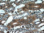 beta Actin Antibody in Immunohistochemistry (Paraffin) (IHC (P))