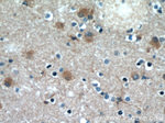 beta Actin Antibody in Immunohistochemistry (Paraffin) (IHC (P))