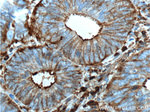 beta Actin Antibody in Immunohistochemistry (Paraffin) (IHC (P))