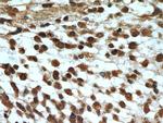 MGEA5 Antibody in Immunohistochemistry (Paraffin) (IHC (P))