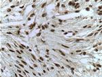 MGEA5 Antibody in Immunohistochemistry (Paraffin) (IHC (P))