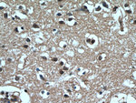 MGEA5 Antibody in Immunohistochemistry (Paraffin) (IHC (P))