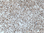 MGEA5 Antibody in Immunohistochemistry (Paraffin) (IHC (P))