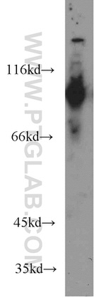 MGEA5 Antibody in Western Blot (WB)