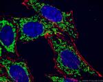 ATP5A1 Antibody in Immunocytochemistry (ICC/IF)