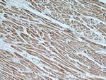 ATP5A1 Antibody in Immunohistochemistry (Paraffin) (IHC (P))