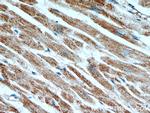 ATP5A1 Antibody in Immunohistochemistry (Paraffin) (IHC (P))