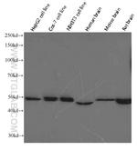 ATP5A1 Antibody in Western Blot (WB)