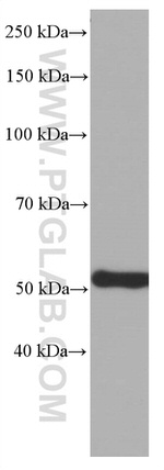 ATP5A1 Antibody in Western Blot (WB)