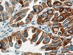 LPCAT1 Antibody in Immunohistochemistry (Paraffin) (IHC (P))