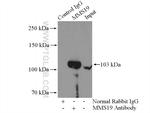 MMS19 Antibody in Immunoprecipitation (IP)