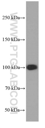 MMS19 Antibody in Western Blot (WB)