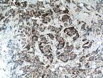 NDUFA4L2 Antibody in Immunohistochemistry (Paraffin) (IHC (P))