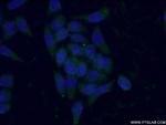 Antithrombin III Antibody in Immunocytochemistry (ICC/IF)