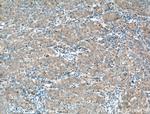 Antithrombin III Antibody in Immunohistochemistry (Paraffin) (IHC (P))