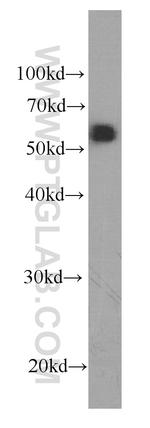 Antithrombin III Antibody in Western Blot (WB)