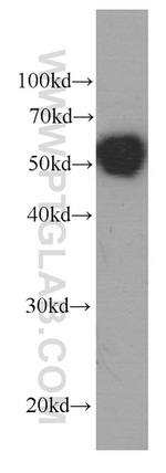 Antithrombin III Antibody in Western Blot (WB)