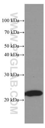 Phospho-TDP43 (Ser403, Ser404) Antibody in Western Blot (WB)