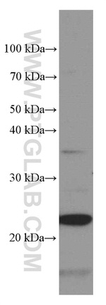 Phospho-TDP43 (Ser403, Ser404) Antibody in Western Blot (WB)