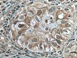 UBE2C Antibody in Immunohistochemistry (Paraffin) (IHC (P))