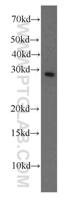 Factor XII Antibody in Western Blot (WB)