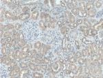 Melanophilin Antibody in Immunohistochemistry (Paraffin) (IHC (P))