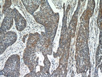 Melanophilin Antibody in Immunohistochemistry (Paraffin) (IHC (P))