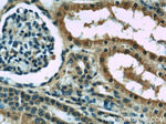 Melanophilin Antibody in Immunohistochemistry (Paraffin) (IHC (P))