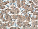 ORM1/2 Antibody in Immunohistochemistry (Paraffin) (IHC (P))