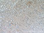 MAOB Antibody in Immunohistochemistry (Paraffin) (IHC (P))