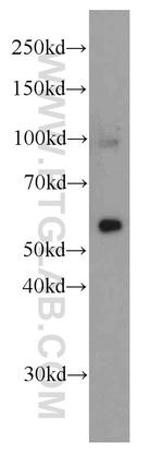 MAOB Antibody in Western Blot (WB)