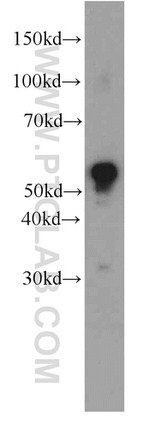 MAOB Antibody in Western Blot (WB)