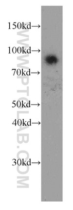 Iduronate 2 sulfatase Antibody in Western Blot (WB)