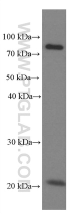 Iduronate 2 sulfatase Antibody in Western Blot (WB)