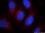 Alpha galactosidase A Antibody in Immunocytochemistry (ICC/IF)