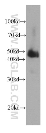 Alpha galactosidase A Antibody in Western Blot (WB)