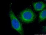 Alpha-2-macroglobulin Antibody in Immunocytochemistry (ICC/IF)