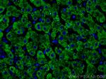 Complement factor B Antibody in Immunohistochemistry (PFA fixed) (IHC (PFA))