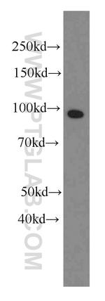 Complement factor B Antibody in Western Blot (WB)