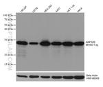 ANP32B Antibody in Western Blot (WB)