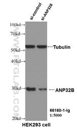 ANP32B Antibody in Western Blot (WB)