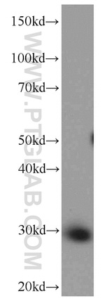 ANP32B Antibody in Western Blot (WB)