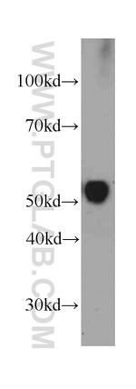 Vitamin D binding protein Antibody in Western Blot (WB)