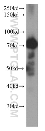 MTA2 Antibody in Western Blot (WB)