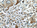 IDH1 Antibody in Immunohistochemistry (Paraffin) (IHC (P))