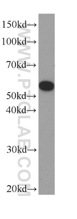 acetylated Tubulin(Lys40) Antibody in Western Blot (WB)