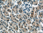 Apolipoprotein AI Antibody in Immunohistochemistry (Paraffin) (IHC (P))