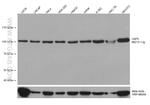 USP5 Antibody in Western Blot (WB)